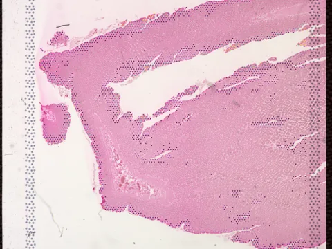 Human colon preview