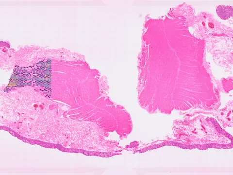 Human colon preview