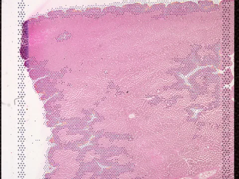 Human colon preview