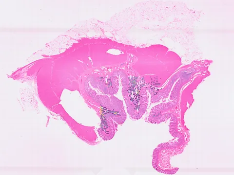 Human colon preview