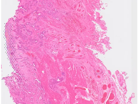 Human colon preview
