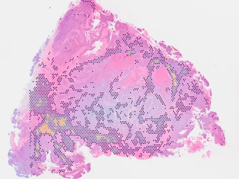 Human colorectum preview