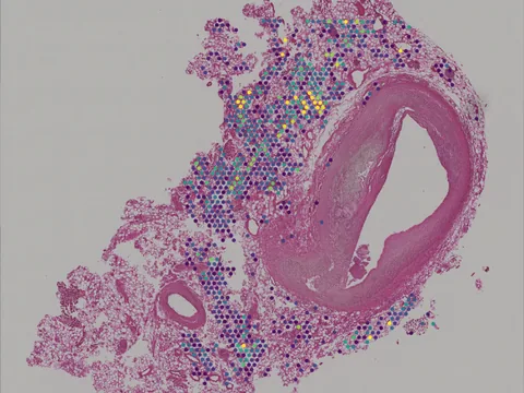 Human coronary artery preview