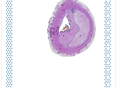Human coronary artery preview