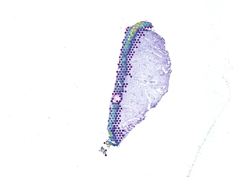 Human ectocervix preview