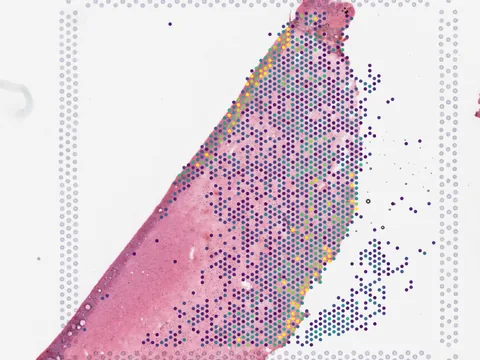 Human entorhinal cortex preview