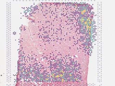 Human entorhinal cortex preview