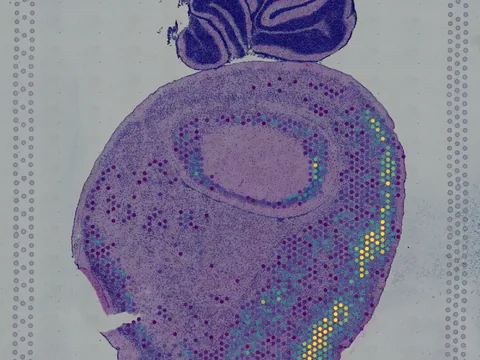 Mouse entorhinal cortex preview