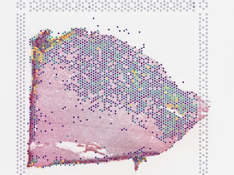 Human entorhinal cortex preview