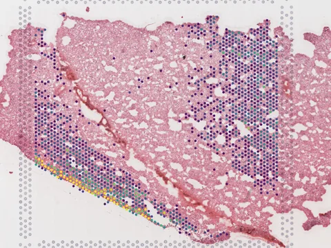 Human entorhinal cortex preview