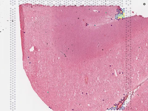 Human entorhinal cortex preview