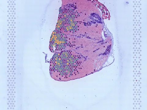 Mouse gastrocnemius preview