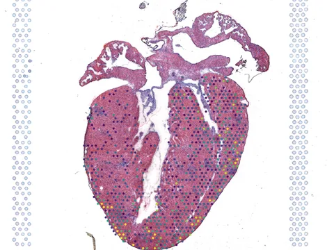 Mouse heart preview
