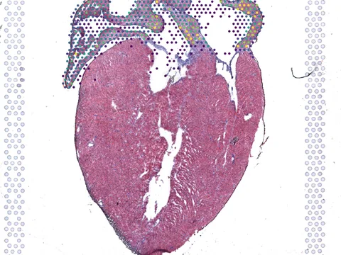 Mouse heart preview