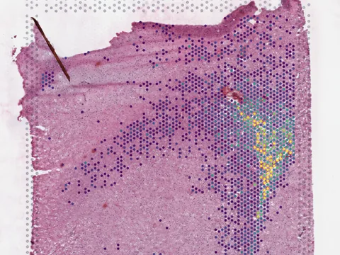 Human hippocampal formation preview
