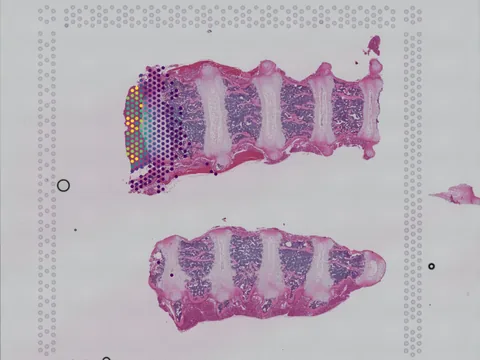 Mouse intervertebral disk preview