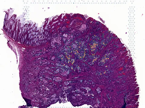 Human intestine preview
