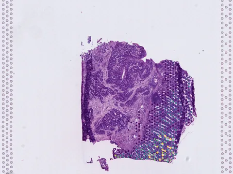 Human intestine preview