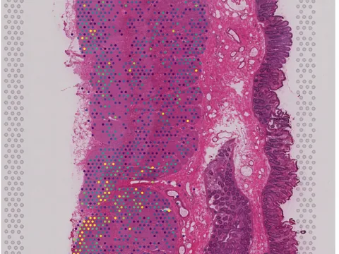 Human intestine preview