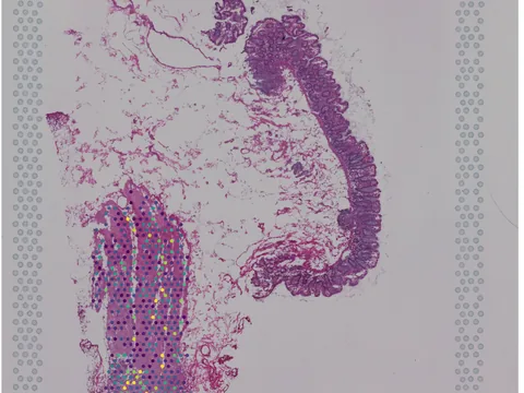 Human intestine preview