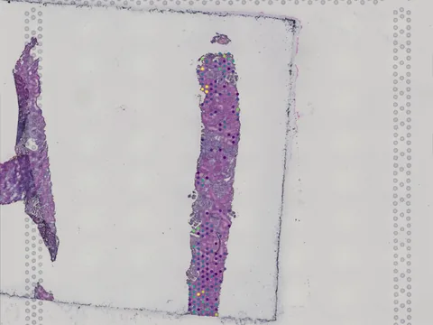 Human kidney preview