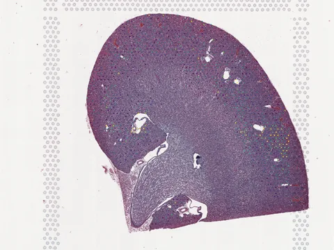 Mouse kidney preview