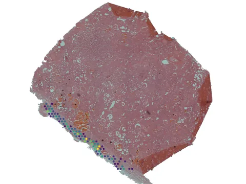 Human kidney preview