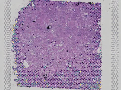 Human kidney preview