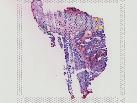 Human kidney preview