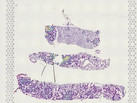 Human kidney preview
