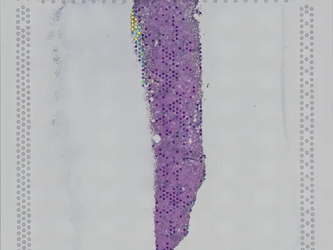 Human kidney preview