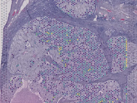 Human kidney preview
