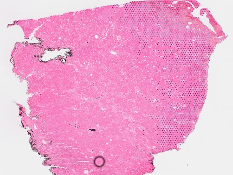 Human kidney preview