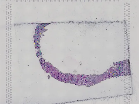 Human kidney preview