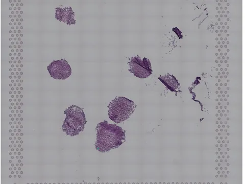 Human kidney preview