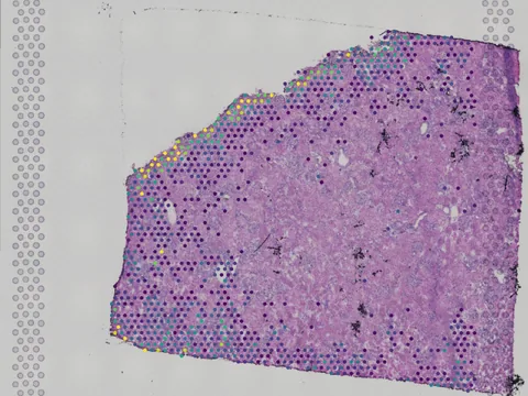 Human kidney preview