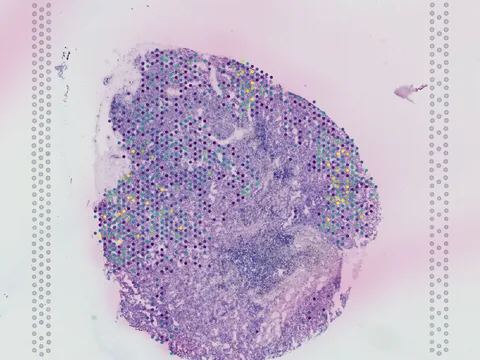 Human kidney preview