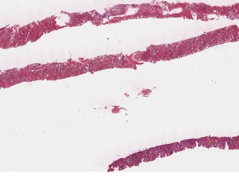 Human kidney preview
