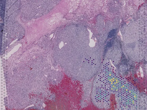Human kidney preview