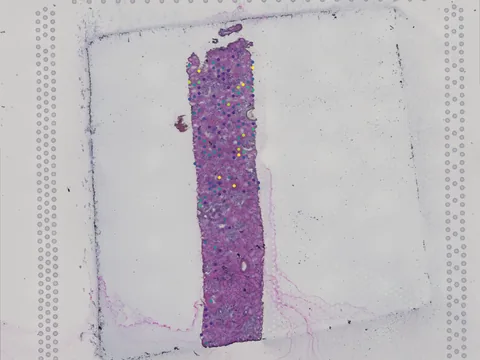 Human kidney preview