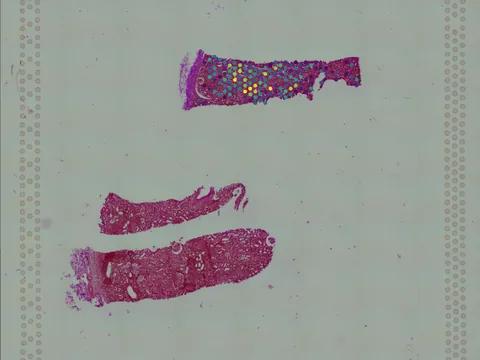 Human kidney preview