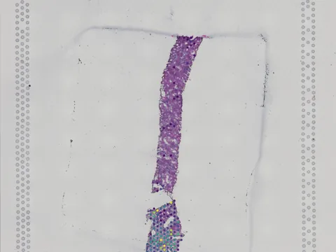 Human kidney preview