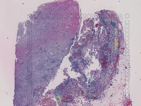 Human kidney preview