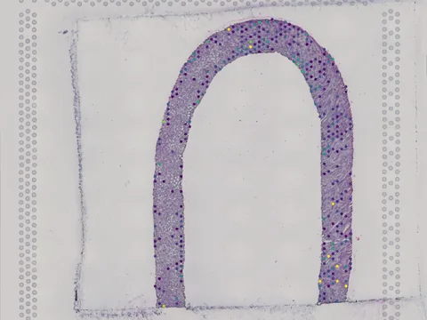 Human kidney preview