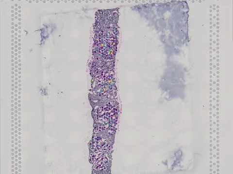 Human kidney preview