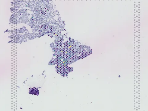 Human kidney preview