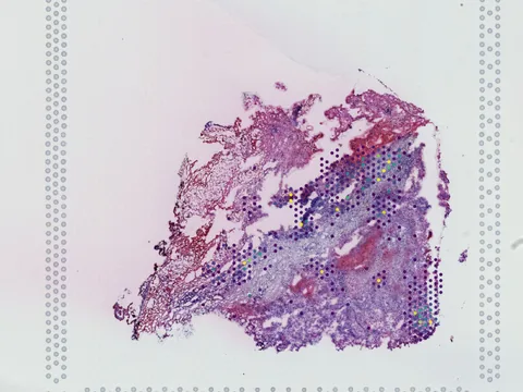 Human kidney preview
