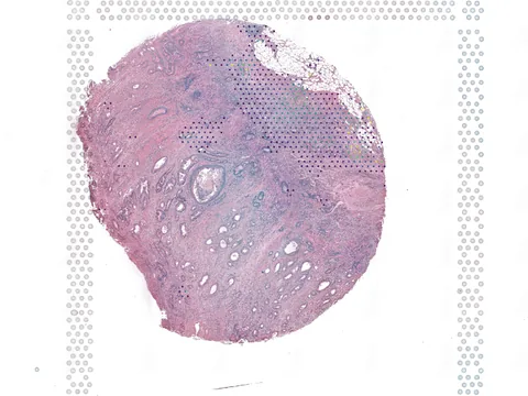 Human large intestine preview