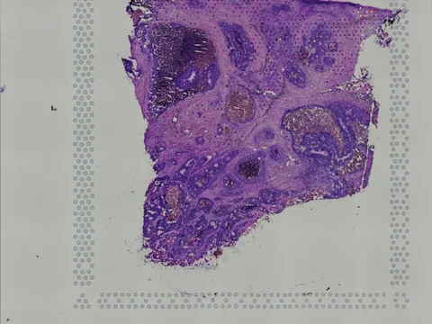 Human large intestine preview