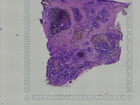 Human large intestine preview